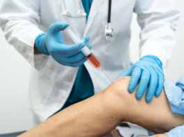 Gonartrosi, efficacia del plasma arricchito di piastrine Gonartrosi, efficacia del plasma arricchito di piastrine