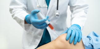 Gonartrosi, efficacia del plasma arricchito di piastrine