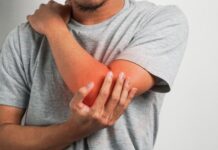 Trattamenti per le fratture del processo coronoideo del gomito