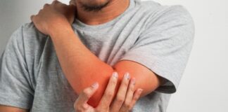 Trattamenti per le fratture del processo coronoideo del gomito