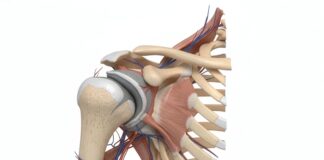 Protesi inversa: un nuovo metodo per il corretto posizionamento componente gleno-omerale