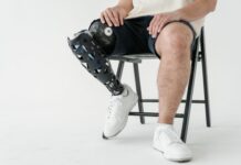 Stabilità dinamica e statica in pazienti con protesi post amputazione transfemorale Stabilità dinamica e statica in pazienti con protesi post amputazione transfemorale