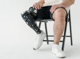 Stabilità dinamica e statica in pazienti con protesi post amputazione transfemorale Stabilità dinamica e statica in pazienti con protesi post amputazione transfemorale