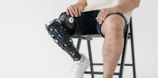 Stabilità dinamica e statica in pazienti con protesi post amputazione transfemorale