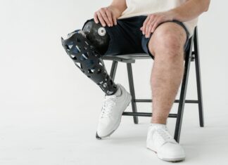 Stabilità dinamica e statica in pazienti con protesi post amputazione transfemorale Stabilità dinamica e statica in pazienti con protesi post amputazione transfemorale