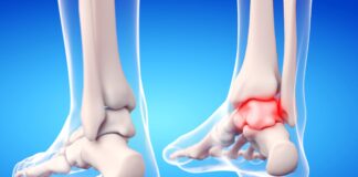 Instabilità di caviglia: gli effetti di un device vibrotattile