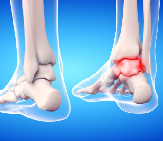 Instabilità di caviglia: gli effetti di un device vibrotattile Instabilità di caviglia: gli effetti di un device vibrotattile