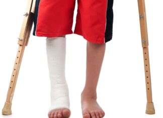 Fratture da stress in bambini e adolescenti: uno studio epidemiologico