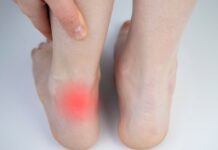 Tendinopatie: individuato un possibile trigger molecolare che avvia la degenerazione dei tendini Tendinopatie: individuato un possibile trigger molecolare che avvia la degenerazione dei tendini