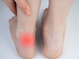 Tendinopatie: individuato un possibile trigger molecolare che avvia la degenerazione dei tendini Tendinopatie: individuato un possibile trigger molecolare che avvia la degenerazione dei tendini