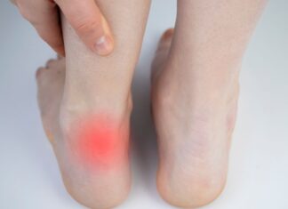 Tendinopatie: individuato un possibile trigger molecolare che avvia la degenerazione dei tendini