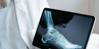 Frattura di caviglia: benefici della crioterapia di terza generazione preoperatoria