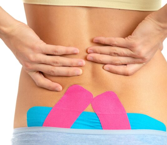 Kinesio taping per il dolore lombare: quanto è davvero efficace Kinesio taping per il dolore lombare: quanto è davvero efficace