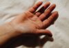 Recupero della funzionalit&agrave; di mano in paziente con tetraplagia incompleta: un caso studio