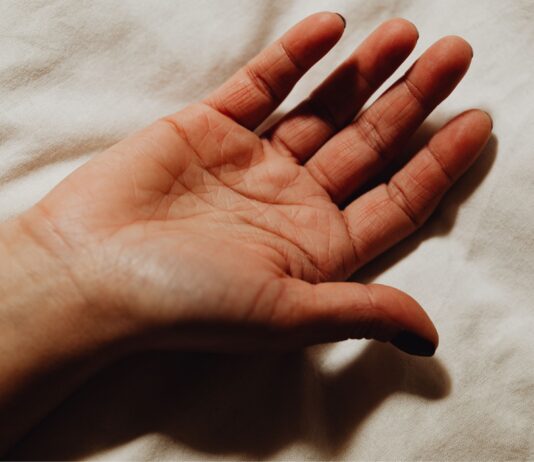 Recupero della funzionalit&agrave; di mano in paziente con tetraplagia incompleta: un caso studio