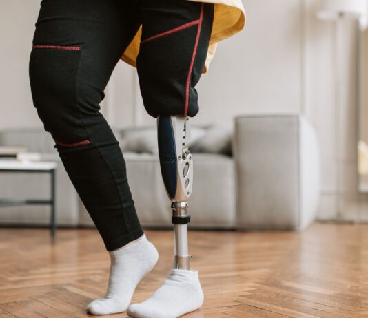 Ausili e protesi: le difficolt&agrave; dei pazienti e le problematiche legate al Nomenclatore