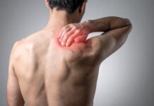 Sindrome da conflitto subacromiale: un approccio riabilitativo efficace