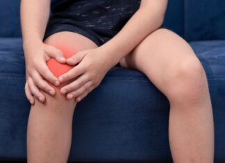 Lussazione traumatica della rotula nei bambini: meglio operare o utilizzare un tutore?