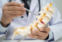 Fratture vertebrali da trauma: diagnosi, cure e riabilitazione Fratture vertebrali da trauma: diagnosi, cure e riabilitazione