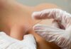 Dry needling, SIMFER: &laquo;Deve restare un atto esclusivamente medico&raquo;