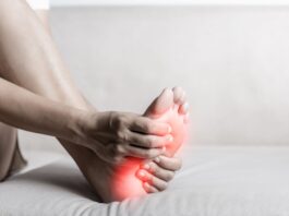 Fascite plantare: i benefici di un approccio manipolativo manuale Fascite plantare: i benefici di un approccio manipolativo manuale
