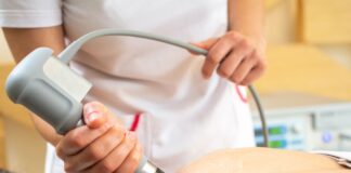 Recupero post ictus dell'arto superiore: efficacia delle onde d'urto extracorporee