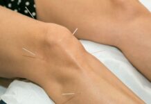Artrosi di ginocchio: agopuntura tradizionale e con dry needling a confronto