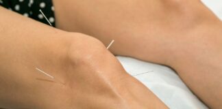 Artrosi di ginocchio: agopuntura tradizionale e con dry needling a confronto
