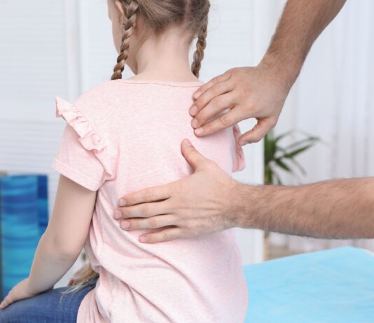 Atrofia muscolare spinale e scoliosi: approccio mini invasivo per i pazienti pediatrici