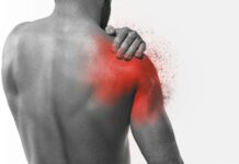 Come riconoscere una lesione alla cuffia dei rotatori Come riconoscere una lesione alla cuffia dei rotatori