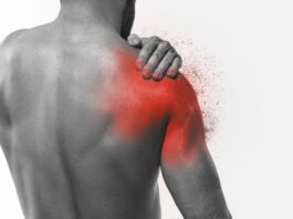 Come riconoscere una lesione alla cuffia dei rotatori