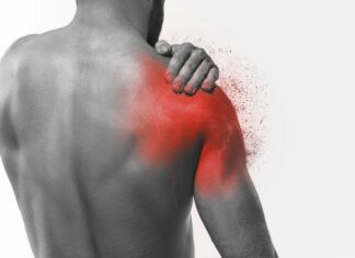 Come riconoscere una lesione alla cuffia dei rotatori Come riconoscere una lesione alla cuffia dei rotatori