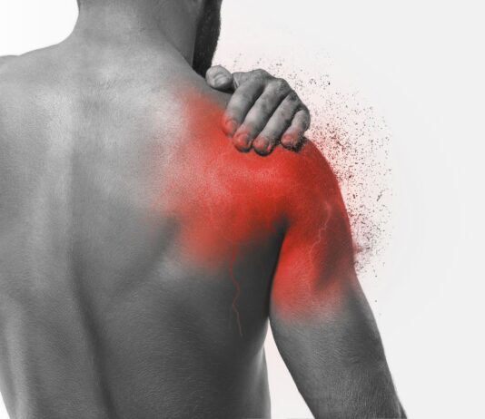 Come riconoscere una lesione alla cuffia dei rotatori Come riconoscere una lesione alla cuffia dei rotatori