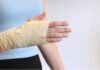 Fratture acute dello scafoide: la stimolazione biofisica aiuta la guarigione? Fratture acute dello scafoide: la stimolazione biofisica aiuta la guarigione?