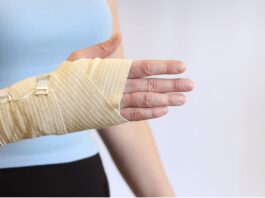 Fratture acute dello scafoide: la stimolazione biofisica aiuta la guarigione? Fratture acute dello scafoide: la stimolazione biofisica aiuta la guarigione?