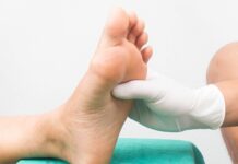 Strategie ortesiche per il piede di Charcot