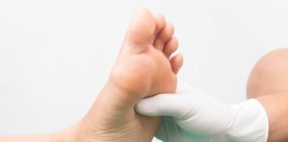 Strategie ortesiche per il piede di Charcot