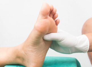 Strategie ortesiche per il piede di Charcot Strategie ortesiche per il piede di Charcot