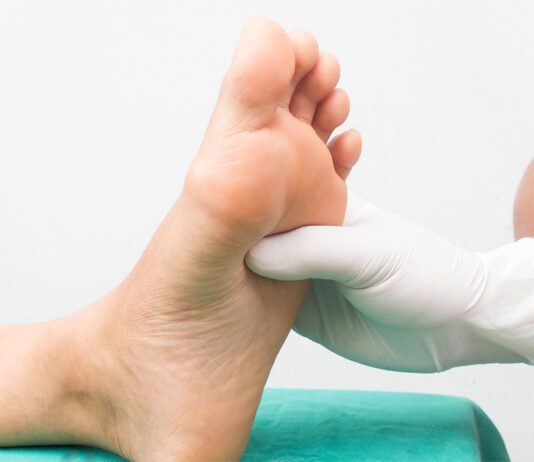 Strategie ortesiche per il piede di Charcot