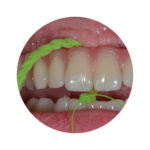 xfloss2