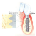 Anatomia-perimplantare