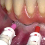 Toronto-utilizzo-di-presidi-di-igiene.