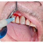 applicazione-del-prodotto