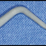 riabilitazione-implantare6