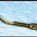 riabilitazione-implantare7