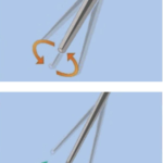 FIG_03