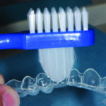 Fig. 10 La rimozione meccanica del biofilm dalla mascherina.