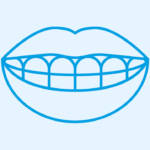 Ortodonzia invisibile