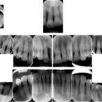 Fig. 3 Full radiografico al baseline.