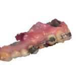 Recupero dell’elemento 13”.